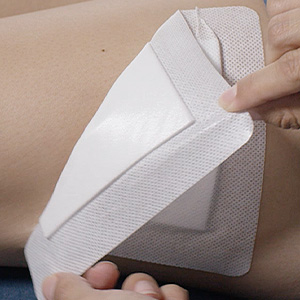 Areza Medical - Bordered Gauze Island Dressing - Wound Dressing - Latex Free - sterile - 6" x 6" - 30 per Box