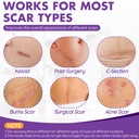 silicone-scar-sheets-silicone-scar-tape--2.jpg