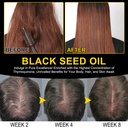 2-pack-black-seed-oil-organic-cold-press-3.jpg