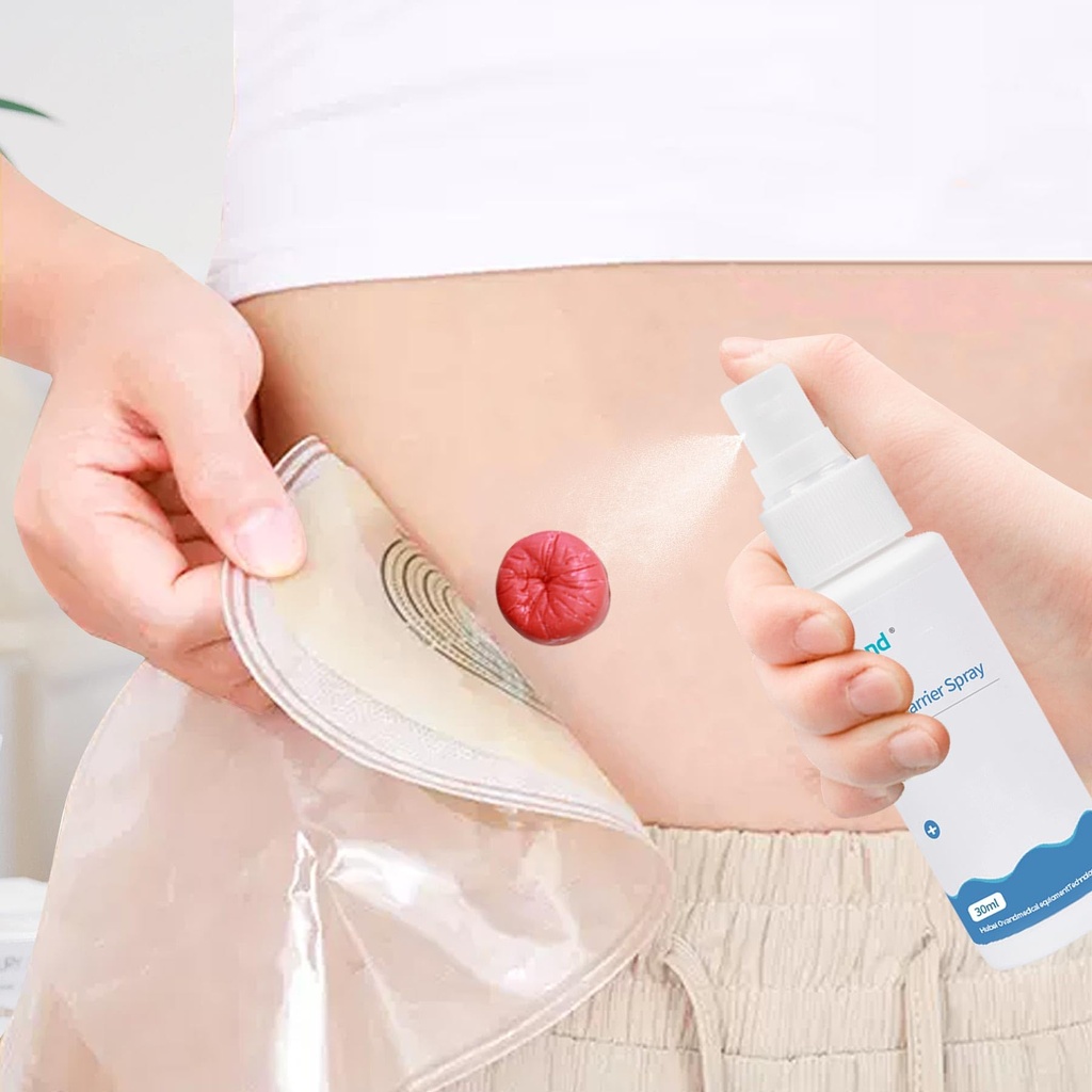 60ml-ostomy-skin-barrier-spray-no-alcoho-5.jpg