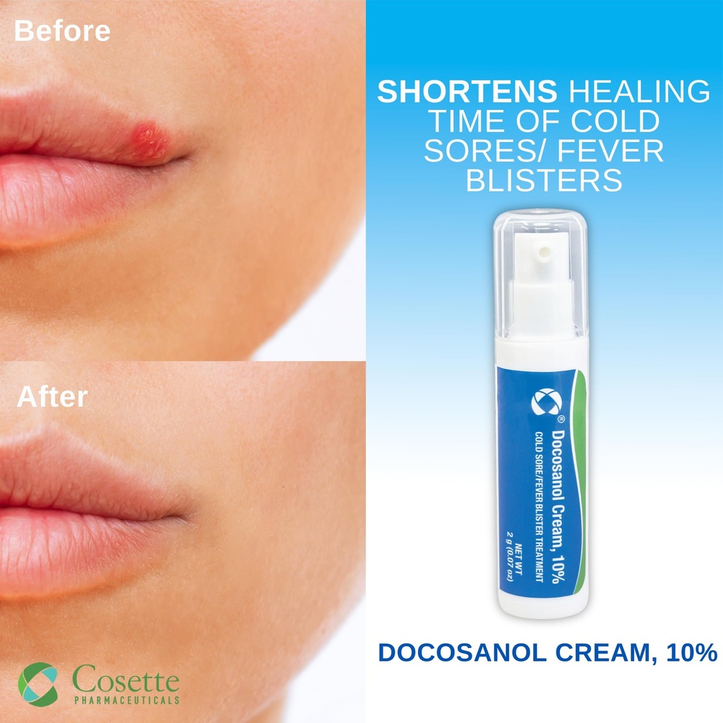 cosette-cold-sore-fever-blister-treatmen-3.jpg