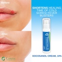 cosette-cold-sore-fever-blister-treatmen-3.jpg