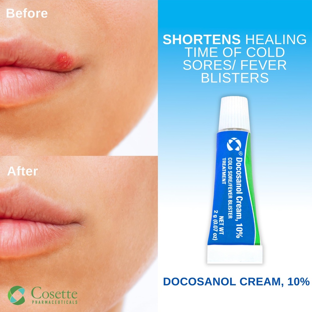 cosette-cold-sore-fever-blister-treatmen-2.jpg