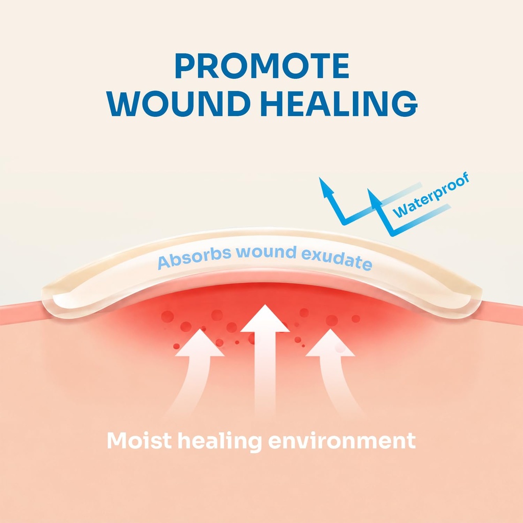 conkote-hydrocolloid-wound-dressings-4-x-4.jpg
