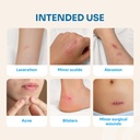 conkote-hydrocolloid-wound-dressings-2-x-5.jpg