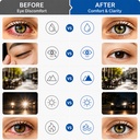 eyemos-hydro-restore-dry-eye-comfort-wit-71k+wNRJHqL.jpg