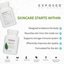 exposed-skin-care-probiotic-supplement-c-4.jpg
