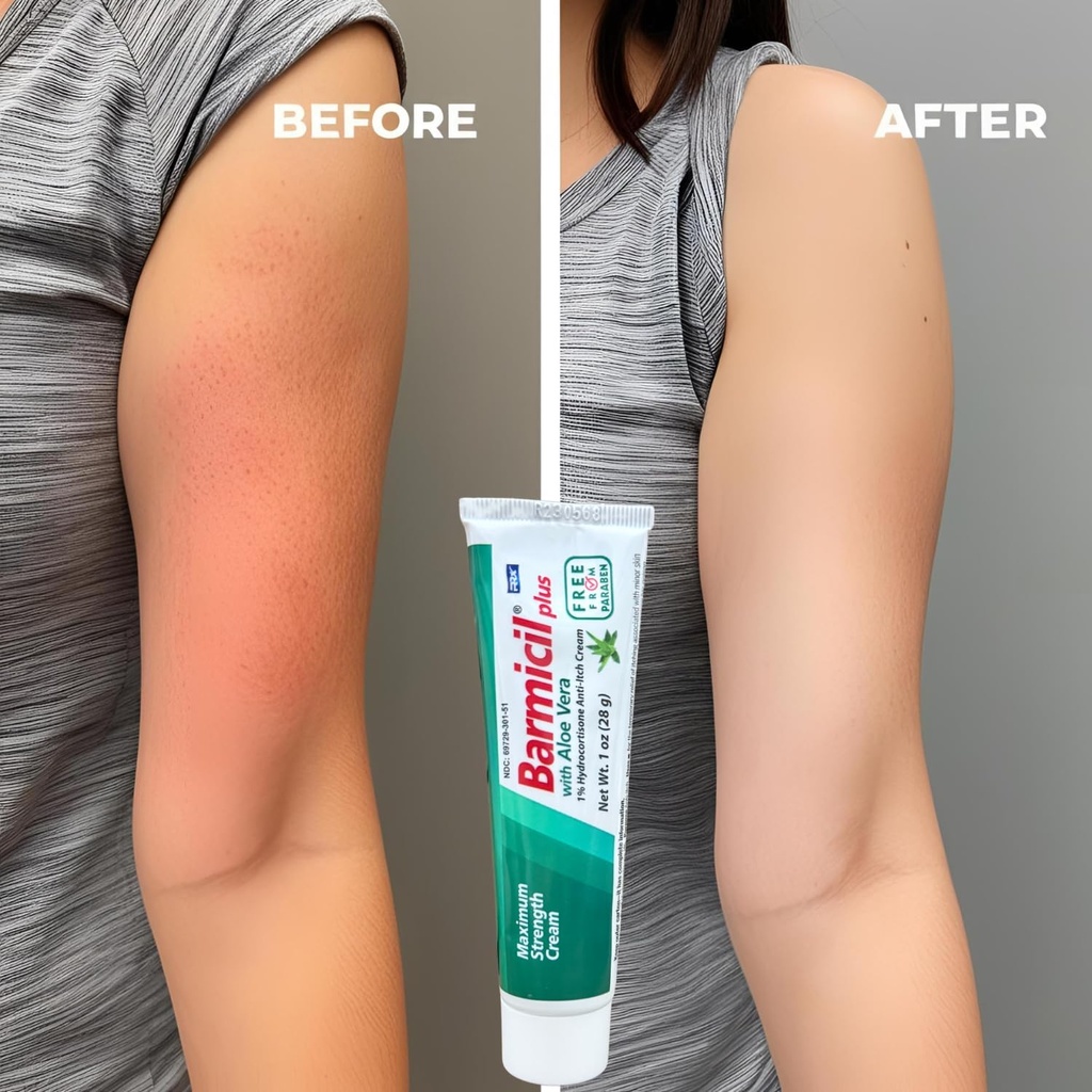 plus-cream-skin-allergies-aloe-vera-with-5.jpg