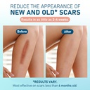 silicone-scar-sheets-10pcs-silicone-tape-3.jpg