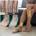 turmeric-varicose-veins-treatment-for-le-2.jpg