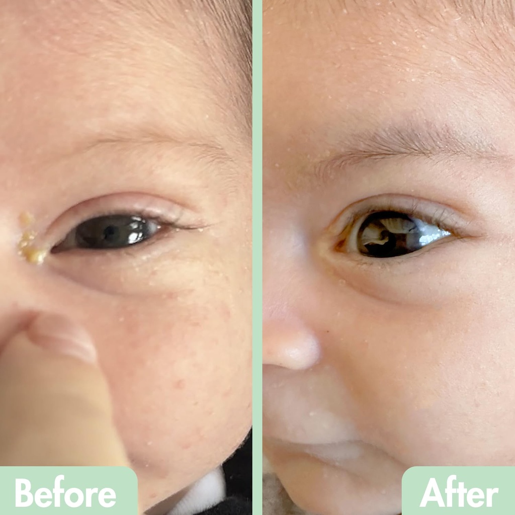 glambaby-eye-care---eye-boogiesTM-eyelid-2.jpg