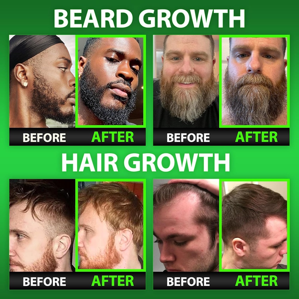 beard-growth-kit-wgrow-11-in-1-hair-grow-5.jpg