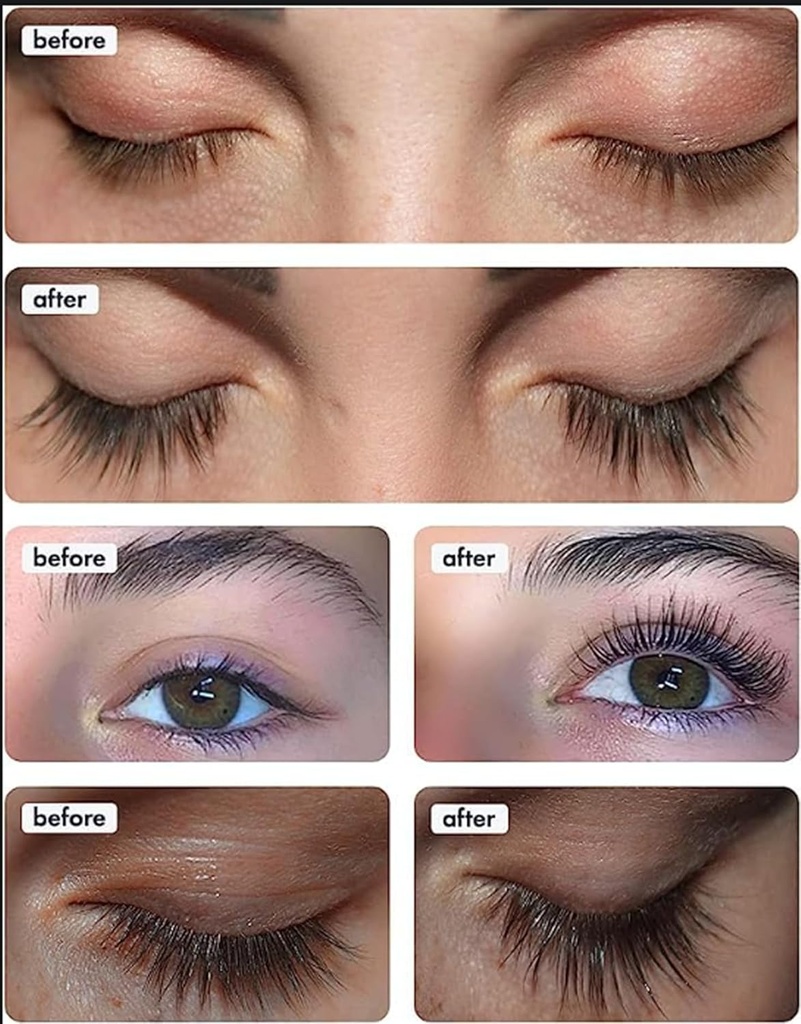 toplash-eyelash-growth-serum---innovativ-4.jpg