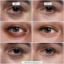eye-cpr-advanced-repairing-treatment-for-2.jpg