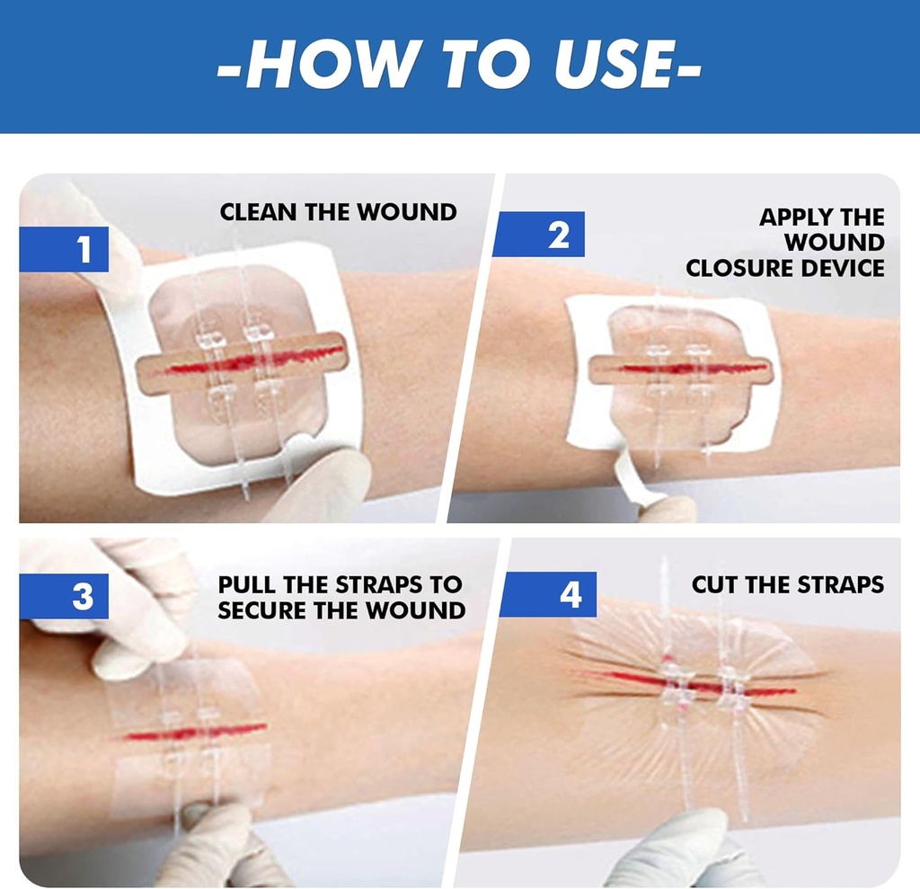 2-pcs-emergency-laceration-closuresbutte-6.jpg