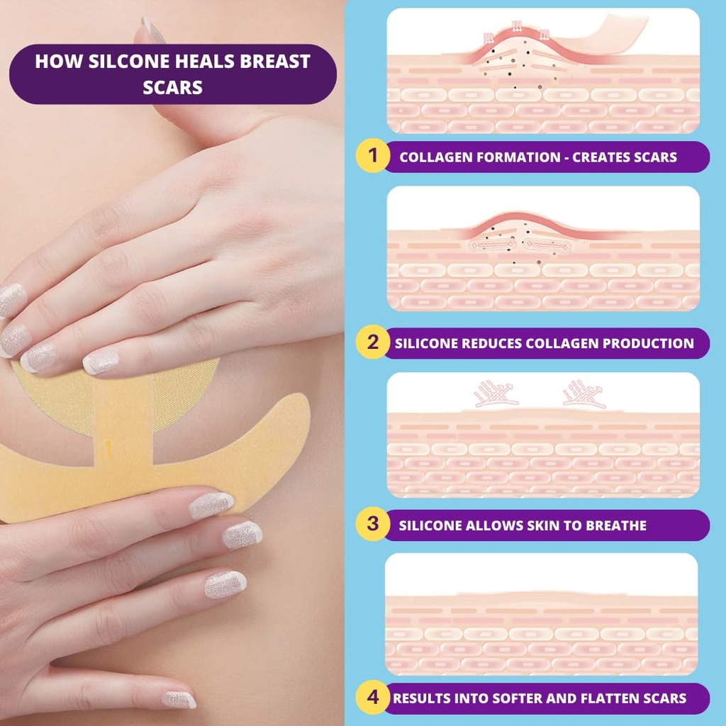 breast-surgery-recovery-essentials---bre-2.jpg