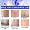 new-transparent-silicone-scar-sheets16-x-5.jpg