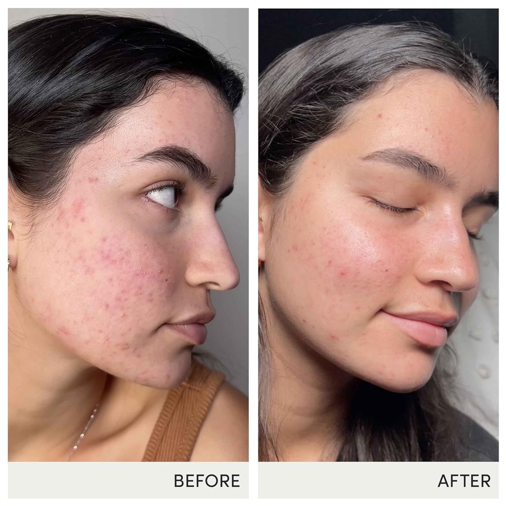 jane-iredale-skin-accumax-nutritional-su-4.jpg