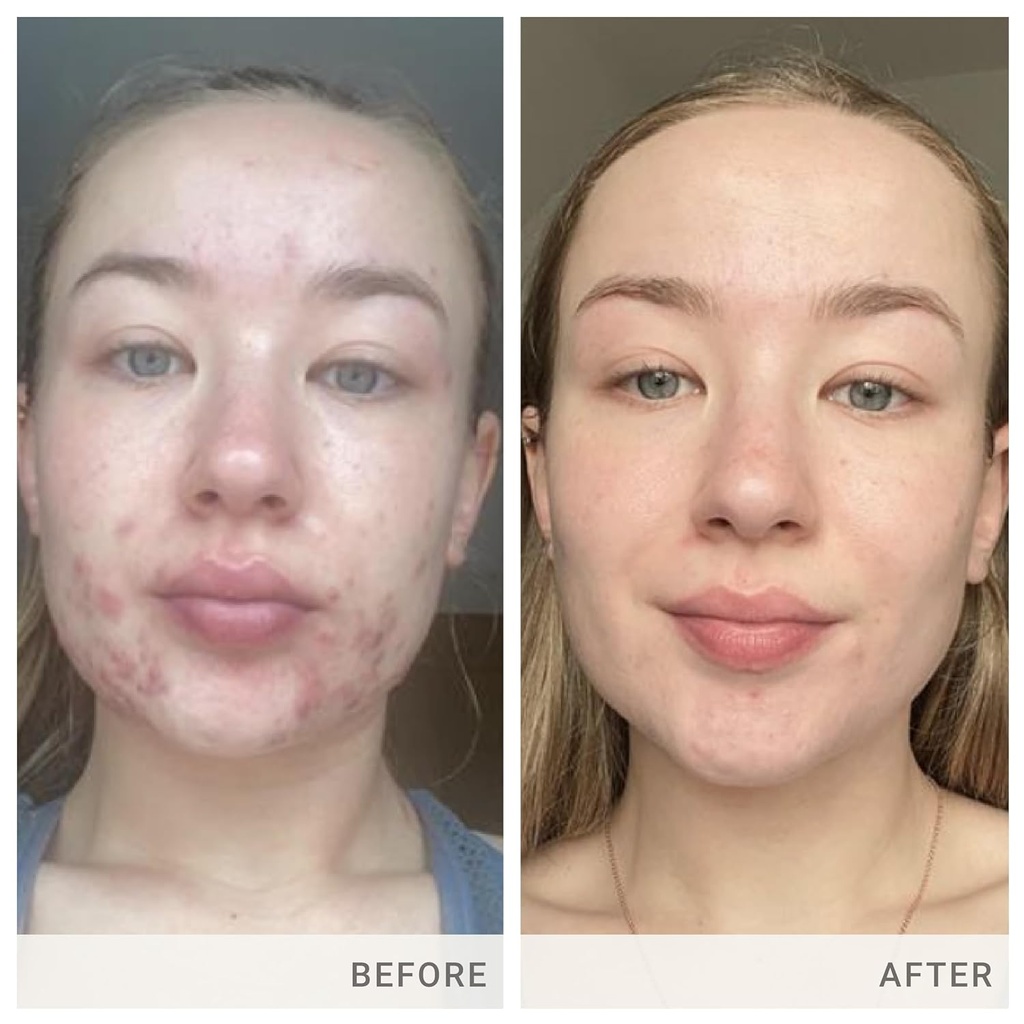 jane-iredale-skin-accumax-nutritional-su-5.jpg