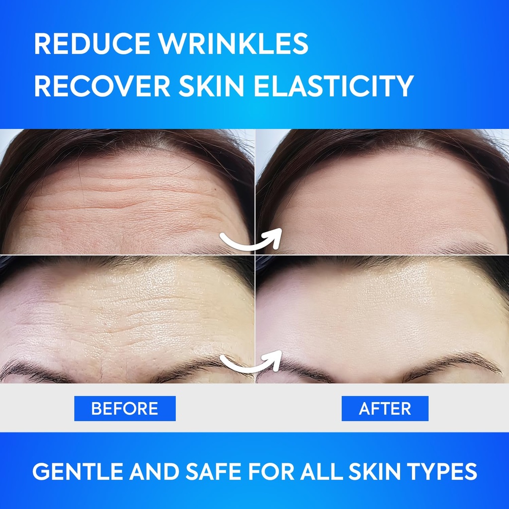 forehead-wrinkle-patches-12pcs-with-aloe-5.jpg