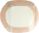 7-x-8-oval-gentle-border-foam-dressing-f-4.jpg