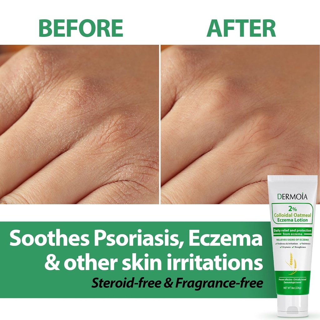 2-colloidal-oatmeal-eczema-lotion---soot-2.jpg