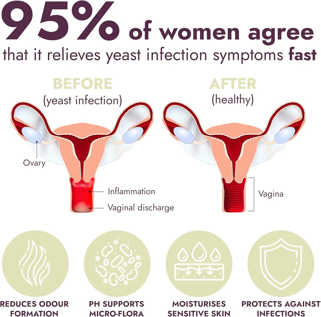 yeast-infection-treatment-for-women-ph-b-3.jpg