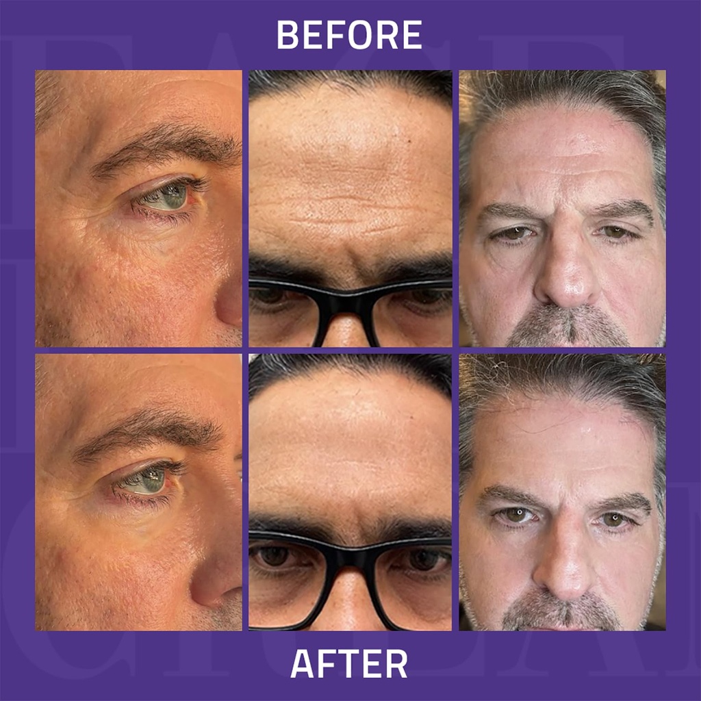 yeouth-instant-face-lift-cream-temporary-6.jpg