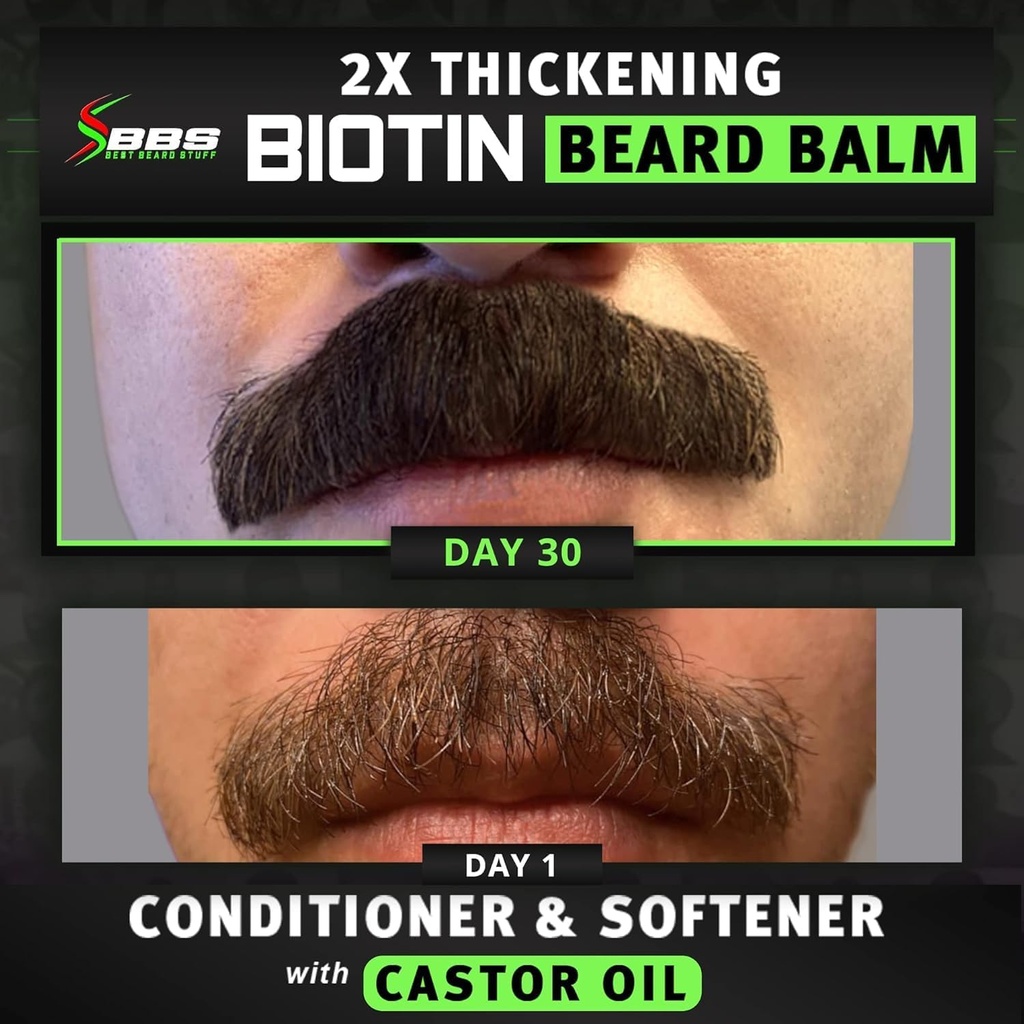 beard-growth-kit-w-2x-thickening-biotin--3.jpg