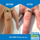 dermasolve-eczema-relief-body-wash-2-pac-3.jpg