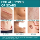 upgrade-silicone-scar-sheets-16-x-120--3-5.jpg