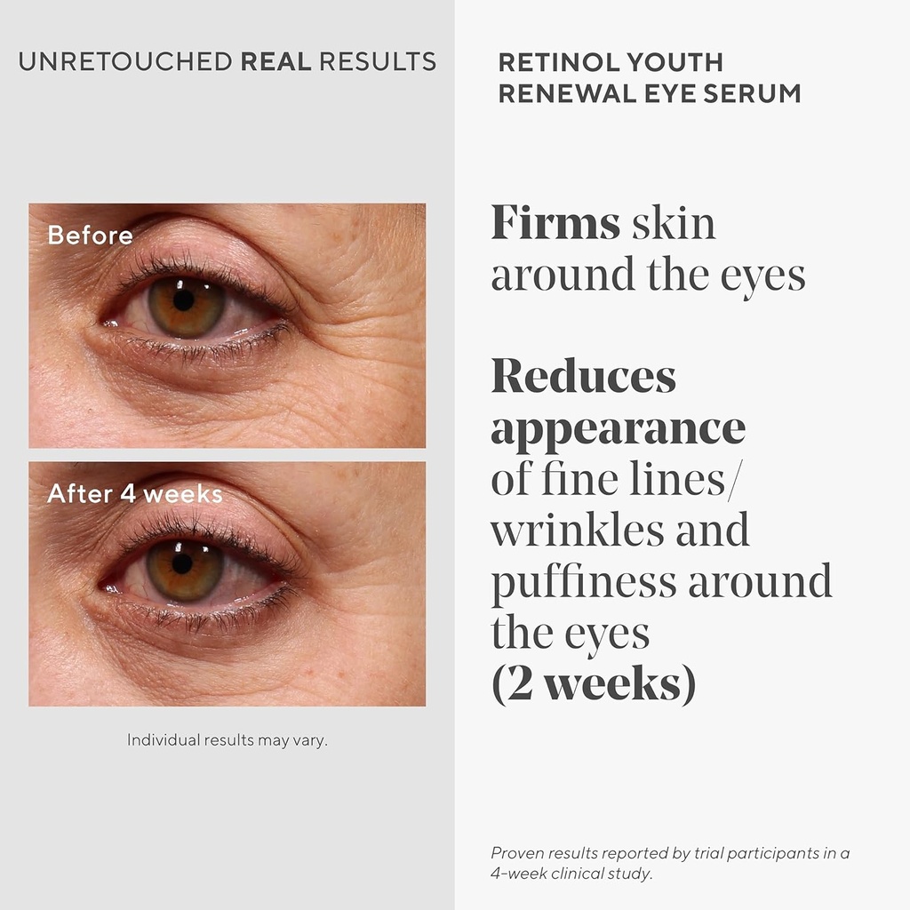 murad-retinol-youth-renewal-eye-serum----3.jpg