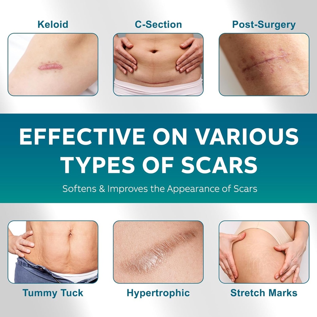 silicone-scar-sheets-silicone-scar-tape1-3.jpg