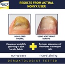 nonyx-fungal-nail-clarifying-gel-clinica-2.jpg