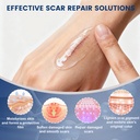 rvlaim-100-silicone-scar-gel-scar-cream--5.jpg