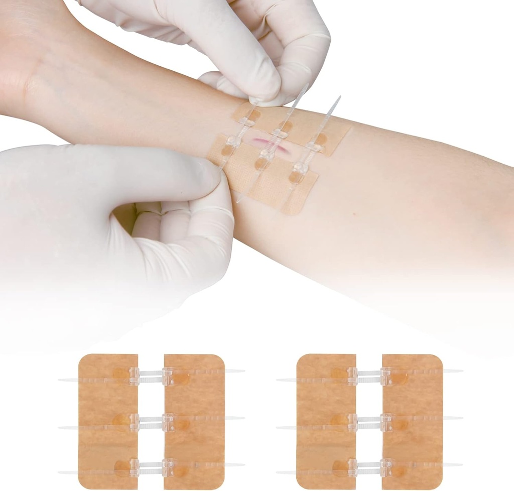 Zip Stitch Laceration Repair Without Stitches Butterfly Bandaaids Quick Clot - Awaryjne zamknięcia rany urządzenia 2 części