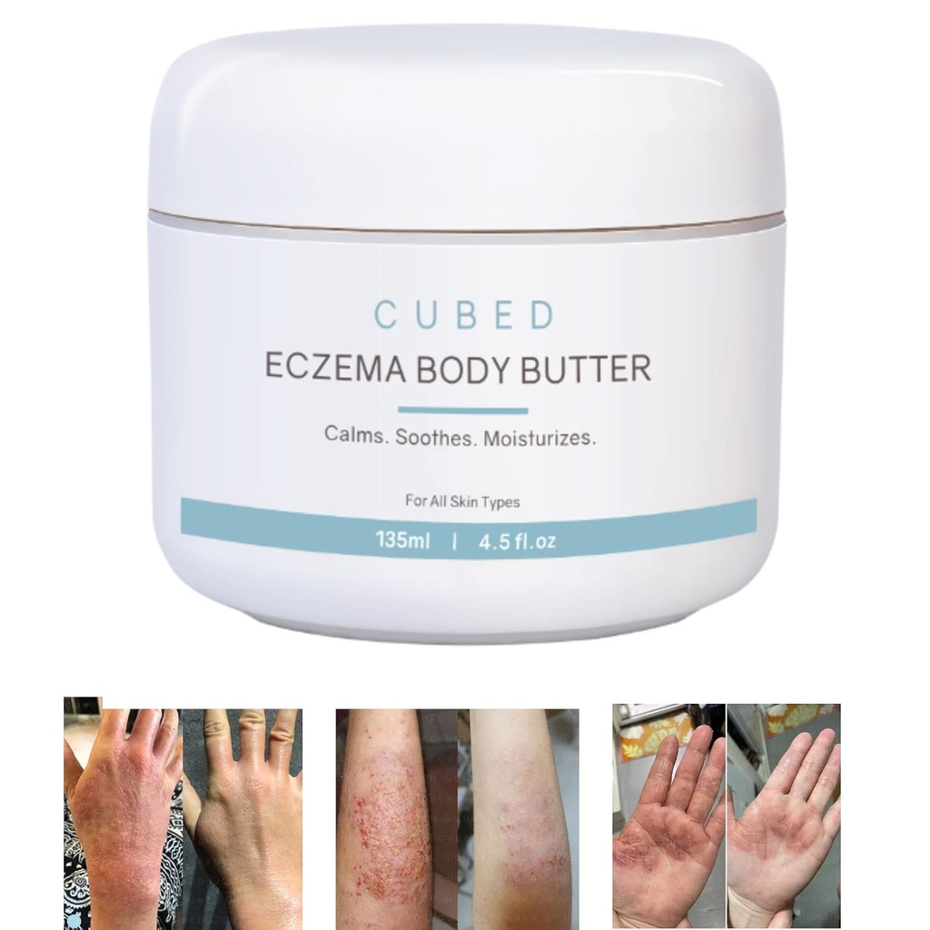 Cubed 4.5 oz Eczema Cream dla dorosłych, Eczema Relief, Eczema Leczenie, Moisturize Suchy Irridated Skóra, Smart Balsam do Chorobowych Steroid objawów odstawienia, Łuszczyca i Rosacea, Eczema, Dermatosis