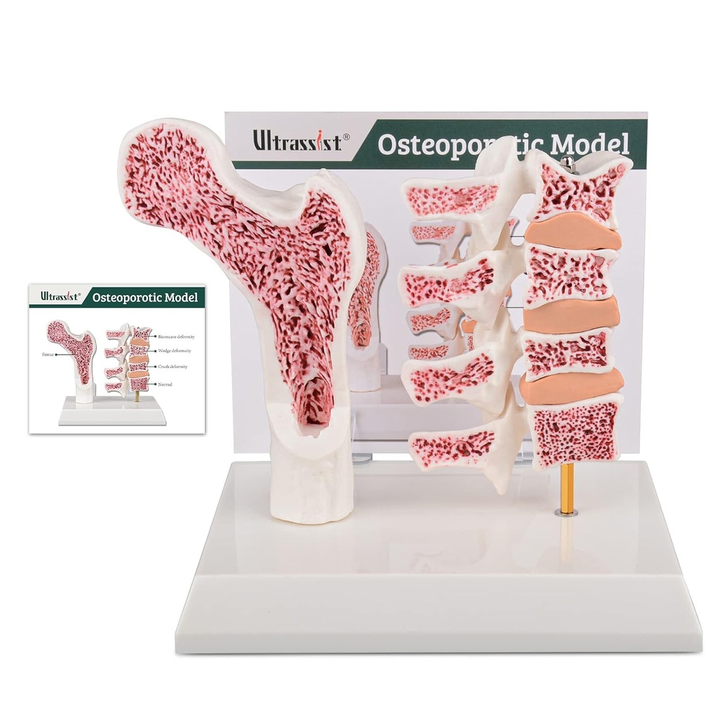 Ultrassist Human Anatomy Osteoporoza Model, Vertebrae Anatomical Szkielet Model z kartą badawczą dla Medical Student Teaching demonstration
