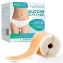 Arkusze z silikonu, taśma z silikonu, arkusze z silikonu do blizn, arkusze z silikonu do twarzy, trądzik, keloid, Burns, znak Stretch, C- section Surgical Scars Removal (1,6 "x 60" Roll- 1,5M)