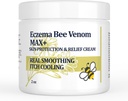 Wysoka wytrzymałość krem Bee Venom, Dyshidrotic Eczema Maść, Wysypka termiczna, Swędzenie, Wyprysk, Łuszczyca, Noga, Żołądek, Stopa, Ręka, Narażona Skóra, Wszystkie wiekowe opieki
