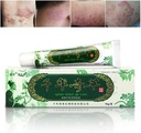 Oversea Thousand-Year Herbal Cream Chiński Eczema Ziołowa, Łuszczyca Creams Dermage i łuszczyca Łuszczyca Ointment