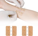 Zip Stitch Laceration Repair Without Stitches Butterfly Bandaaids Quick Clot - Awaryjne zamknięcia rany urządzenia 2 części
