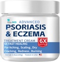 Bio- MD Łuszczyca Wyprysk krem, Wyprysk krem dla dorosłych, Extra Strength Control Revention, Relieve Symptom Oporu, Skuteczny w chorobach łojotokowych, Leczenie zapalenie stawów