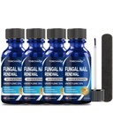 4Pcs Leczenie grzyba paznokci, 25% Kwas undecylenowy, Leczenie grzyba paznokci paznokci, Leczenie grzyba paznokci (2 FL OZ)